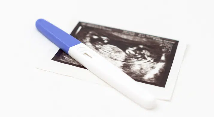 pregnancy ultrasound